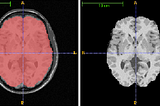 Preprocessing MRI in Python
