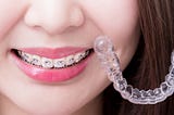 Cost-effective orthodontic treatment with invisible braces in Singapore at Figs Dental.