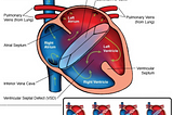 Flu Season and Heart Defects