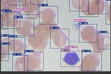 Fast and Accurate Blood Cell Counting with YoLo v7: A State-of-the-Art Object Detection Algorithm