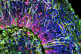 No Two Brains Are the Same: How Neuroscience Is Advancing to Account for This