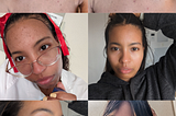 Tretinoin