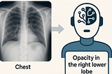 Fine-Tuning MedGemma-4B-IT on Chest X-Rays (ReXGradient) for Under $5: A Lite Evaluation Experiment