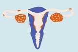 Using Electrochemical Immunosensors To Detect And Diagnose Endometriosis