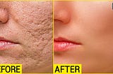 Face ko Smooth kaise kare | Repair Skin in Photoshop