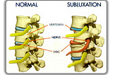 5 Months of Chiropractor, Here’s What Happened