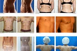 Vaser Liposuction Cost in India — Abdominal Liposuction cost in India — Vaser Lipo Laser Cost in…