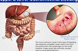 Surgery for Obscure Lower Gastrointestinal Bleeding in India