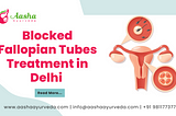 Blocked Fallopian Tubes Treatment in Delhi