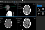 Dicom Read Library (Apache Spark Third Party Contribution)