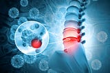 What Exactly is a Subluxation?