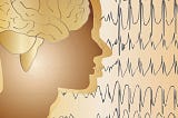 Epileptic seizures