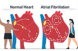 Palpitations, atrial fibrillation and thyroid terror.