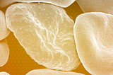 An up-close view of blood cells, with a transparent yellow overlay.