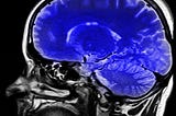 Why Traditional Goal Setting Fails for ADHD Brains (And What Actually Works)