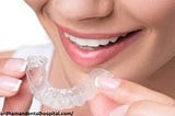 Invisible Braces: Treatment, Procedure, Cost and Side Effects