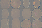 Using CNNs to Diagnose Diabetic Retinopathy