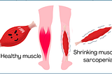 Image of a healthy leg muscle compared to a shrinking muscle of sarcopenia
