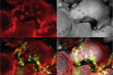 Finding a missing puzzle piece in the mitochondrial processing pathway