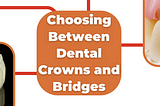 Dental crowns and bridges