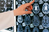 A hand pointing to one of a number of MRI brain scans on a screen. Only the hand and part of the forearm are visible. It appears that the owner of the hand is wearing a lab coat.
