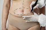 Can Mommy Makeover Surgery Be Done in Stages?