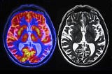 What the Studies Say About How AI Affects Your Brain: A (Very Big) Compilation