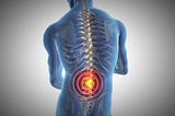 5 Ways to Relieve Back Pain