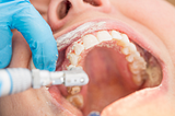 How Bad Oral Health Goes Straight to Your Heart