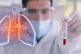 LUNGS HEALTH IS DYNAMIC 8 INCREDIBLE FOODS You May Know or Not