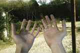 Distorted image of 2 hands with trees in the background. Distortion in tunnel vision, contrast and colors reflects the experience of DPDR.