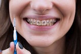 How to Whiten Teeth While Wearing Braces?
