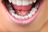 Dental Emergencies 101: Handling Sudden Dental Problems