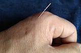 This a photo with an acupuncture needle injected into my hand. The needle is 0.16mm in diameter and 3cm long.
 The place that injected a needle is a famous acupuncture trigger point named Goukoku. It is stabbed to a depth of about 5 mm.