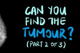 Can You Find the Breast Tumours? (Part 2 of 3)