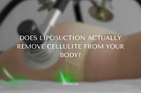 Does liposuction actually remove cellulite from your body?