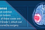 Blood Cancer Drugs Show Promise for Treating Meningiomas