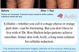 Cellulite Reduction