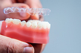 What are the Benefits of Invisalign for You?
