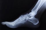 The Broken Foot Analogy: Identifying Common (and Stupid) Fallacies