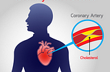 South African Coronary Heart Disease