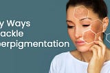 Easy Ways To Tackle Hyperpigmentation