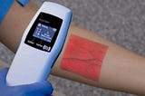 Vein Finder vs. Traditional Methods: Which Reigns Supreme in 2024?