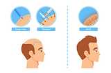 Finding the Right Hair Transplant Clinic near You: What to Consider