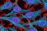 The Immortal Cells of Henrietta Lacks