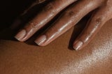 Is Complexion Open to Interpretation?