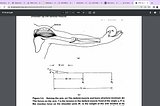 What I’m Learning in Physical Therapy School: Triangles