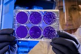A scientist in a lab coat and protective face shield and gloves closely examines a multi-well plate holding purple-stained bacterial cultures in a laboratory setting.
