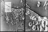 Mycoplasma: The micron sized carcinogenic protozoan