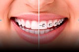 Lach Orthodontic Specialists: Engineering the Perfect Smile